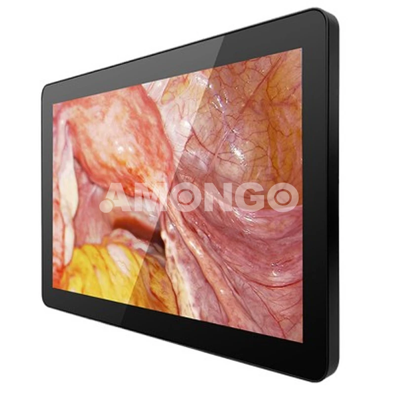 Nhà sản xuất màn hình y tế AMG 15optd01g1